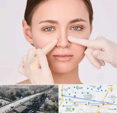 جراح راینوپلاستی در فرجام