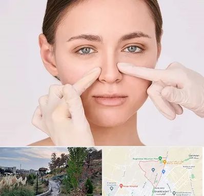 جراح راینوپلاستی در باغستان کرج