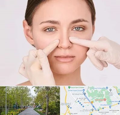 جراح راینوپلاستی در قدوسی غربی شیراز