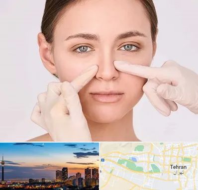 جراح راینوپلاستی در غرب تهران