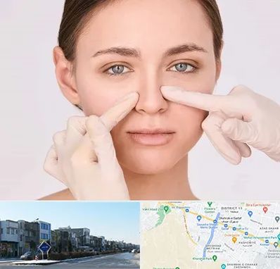 جراح راینوپلاستی در شریعتی مشهد