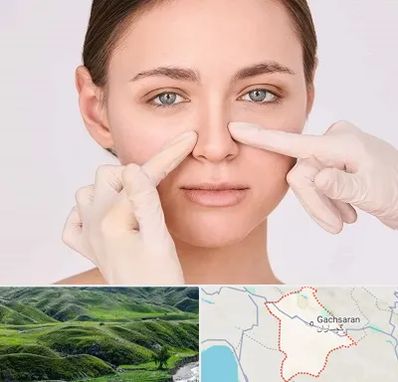 جراح راینوپلاستی در گچساران