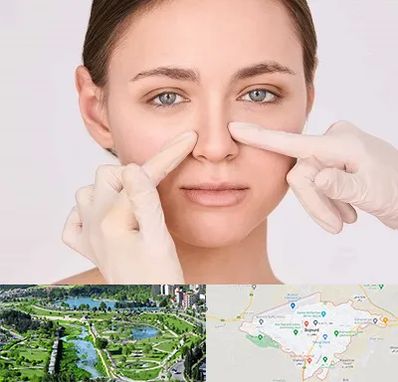جراح راینوپلاستی در بجنورد