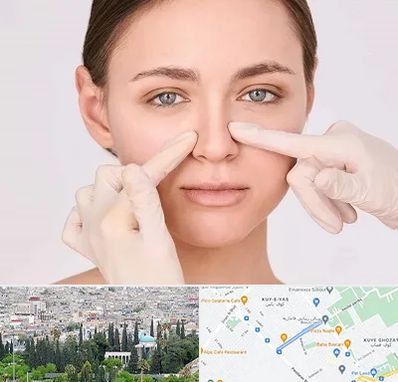 جراح راینوپلاستی در محلاتی شیراز