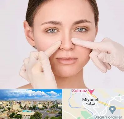 جراح راینوپلاستی در میانه