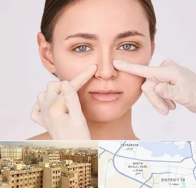 جراح راینوپلاستی در جنوب غرب تهران