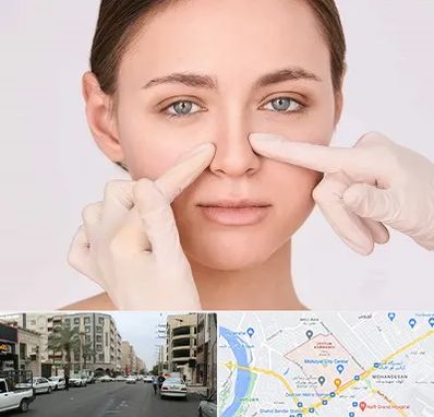 جراح راینوپلاستی در زیتون کارمندی اهواز