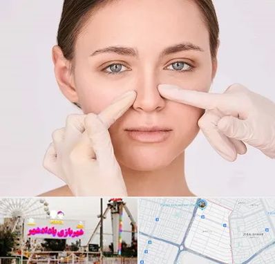 جراح راینوپلاستی در پادادشهر اهواز