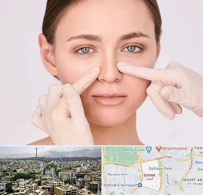 جراح راینوپلاستی در گیشا