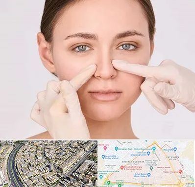 جراح راینوپلاستی در شهرک غرب مشهد