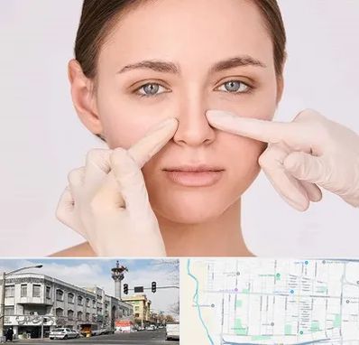 جراح راینوپلاستی در 17شهریور