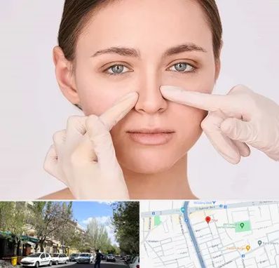 جراح راینوپلاستی در کوی فیروز تبریز