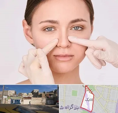 جراح راینوپلاستی در اتابک