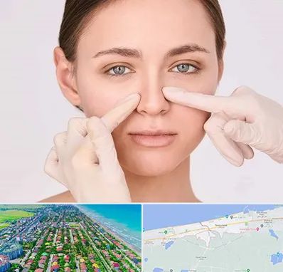 جراح راینوپلاستی در فریدونکنار