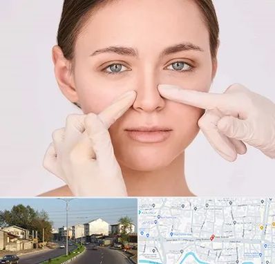 جراح راینوپلاستی در ضیابری رشت