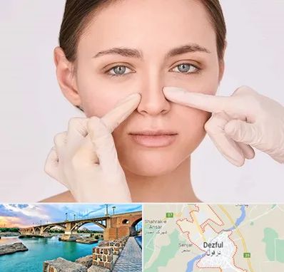 جراح راینوپلاستی در دزفول