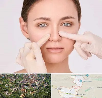 جراح راینوپلاستی در دماوند