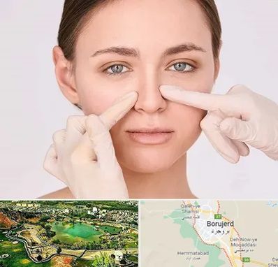 جراح راینوپلاستی در بروجرد