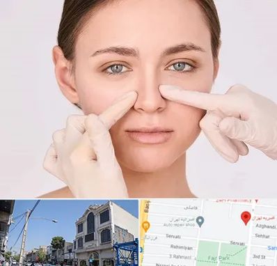 جراح راینوپلاستی در افسریه