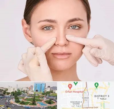 جراح راینوپلاستی در ونک