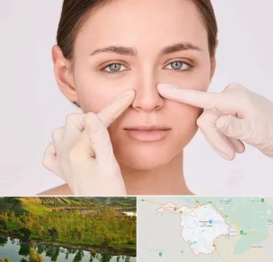 جراح راینوپلاستی در بهبهان
