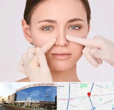 جراح راینوپلاستی در نصف راه تبریز