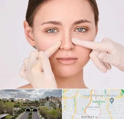 جراح راینوپلاستی در یوسف آباد