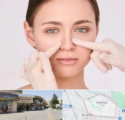 جراح راینوپلاستی در پرواز تبریز