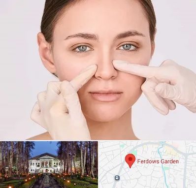 جراح راینوپلاستی در باغ فردوس