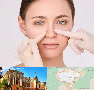 جراح راینوپلاستی در خوی