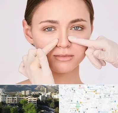 جراح راینوپلاستی در دیباجی