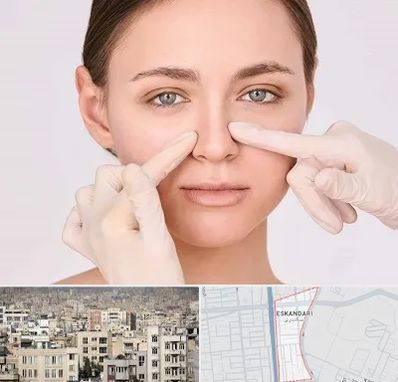 جراح راینوپلاستی در اسکندری