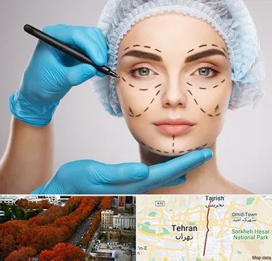 جراح فک و صورت در ولیعصر