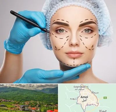 جراح فک و صورت در آمل