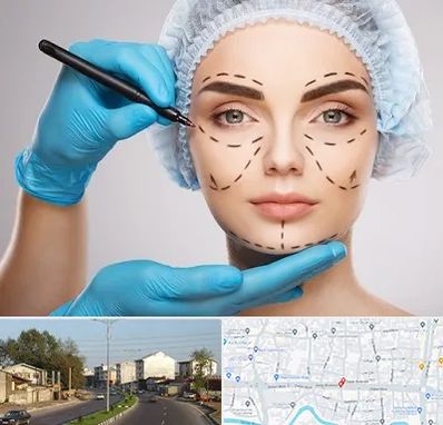 جراح فک و صورت در ضیابری رشت