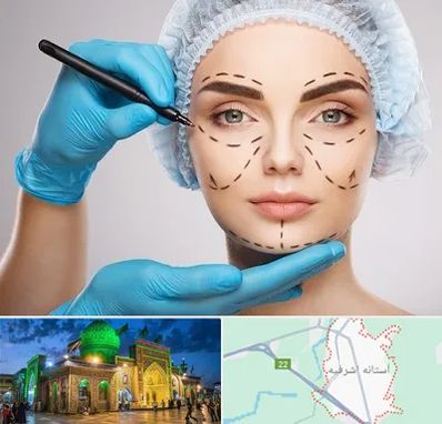 جراح فک و صورت در آستانه اشرفیه