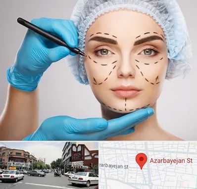 جراح فک و صورت در خیابان آذربایجان