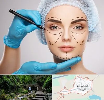 جراح فک و صورت در علی آباد کتول