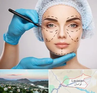 جراح فک و صورت در لواسان