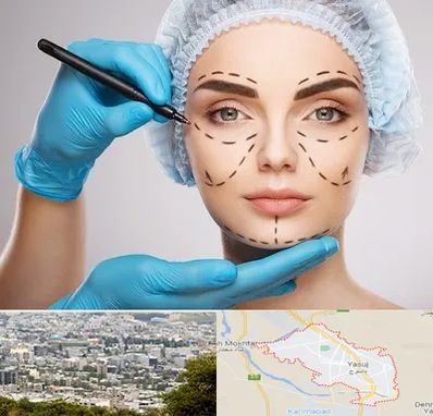 جراح فک و صورت در یاسوج