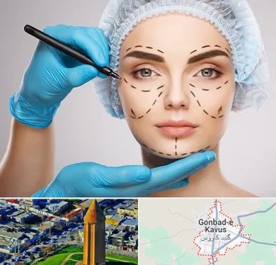 جراح فک و صورت در گنبد کاووس