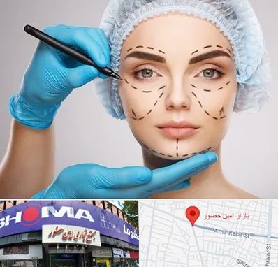 جراح فک و صورت در امین حضور