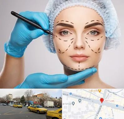 جراح فک و صورت در شهناز تبریز