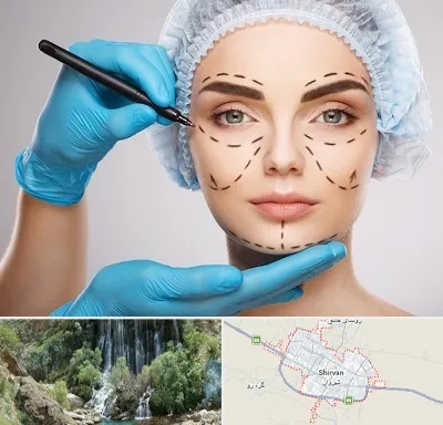 جراح فک و صورت در شیروان