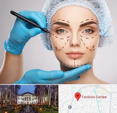 جراح فک و صورت در باغ فردوس