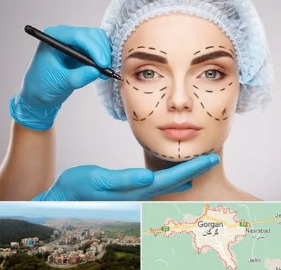 جراح فک و صورت در گرگان