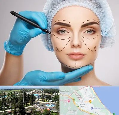 جراح فک و صورت در رودسر