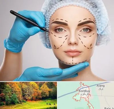 جراح فک و صورت در کردکوی