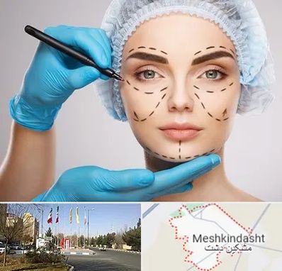 جراح فک و صورت در مشکین دشت