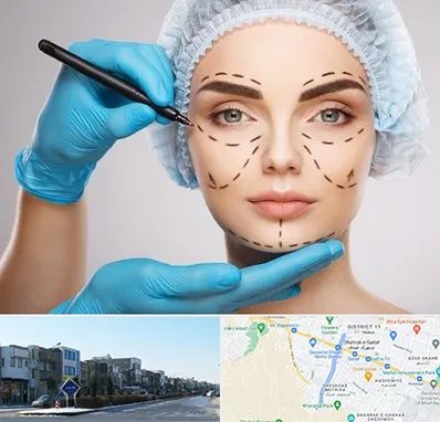 جراح فک و صورت در شریعتی مشهد